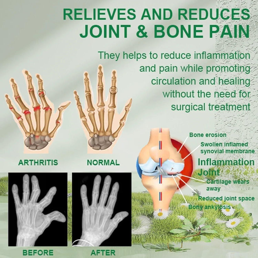 Bee Venom Ultra Strength Pain Relief Cream |đ„ BUY 1 GET 2 FREEđ„