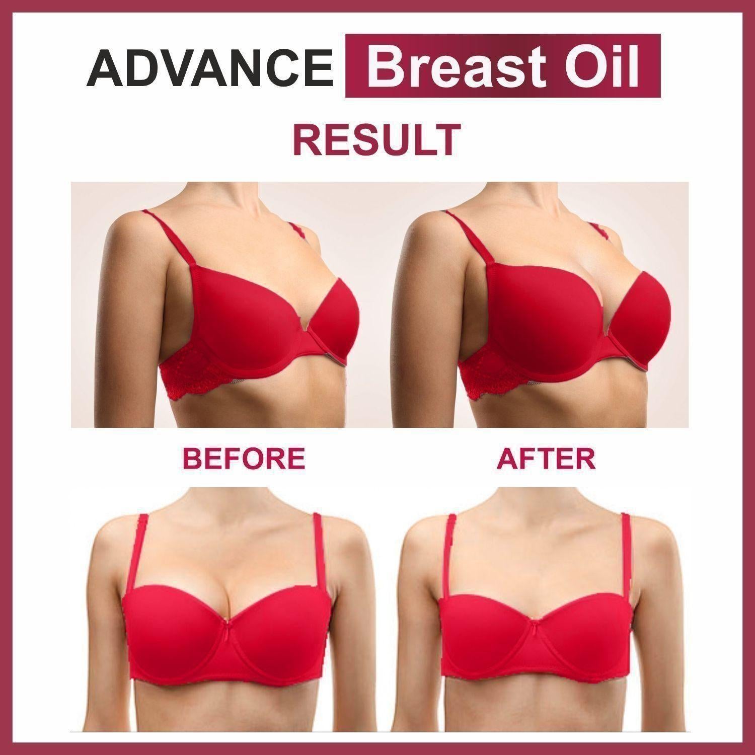 Ollanic Advance Breast Oil