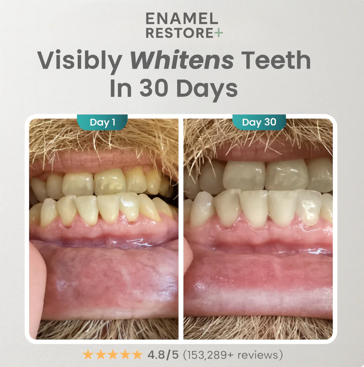 Buy 1 Get 1 Free | Enamel Restore+|  Nano-Hydroxyapatite toothpaste